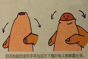 呼和浩特怎么让包皮缩短(呼和浩特割包皮大概得多少钱)