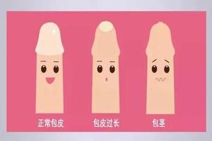 呼和浩特男人平时龟头露不出来算不算包皮(呼和浩特男科医院过度治疗花费六万多)