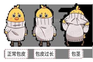 呼和浩特男人包皮过长什么特征(内蒙古的男的大不大)