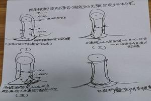 呼和浩特无痕包皮吻合术(呼和浩特包茎手术)