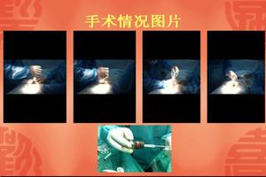 呼和浩特市中医院包皮手术(呼和浩特看男性性功能老中医)