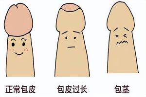 呼和浩特小孩子割包皮(呼和浩特割包皮多少钱)