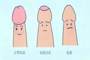 呼和浩特男友包皮(呼和浩特男生的特征)